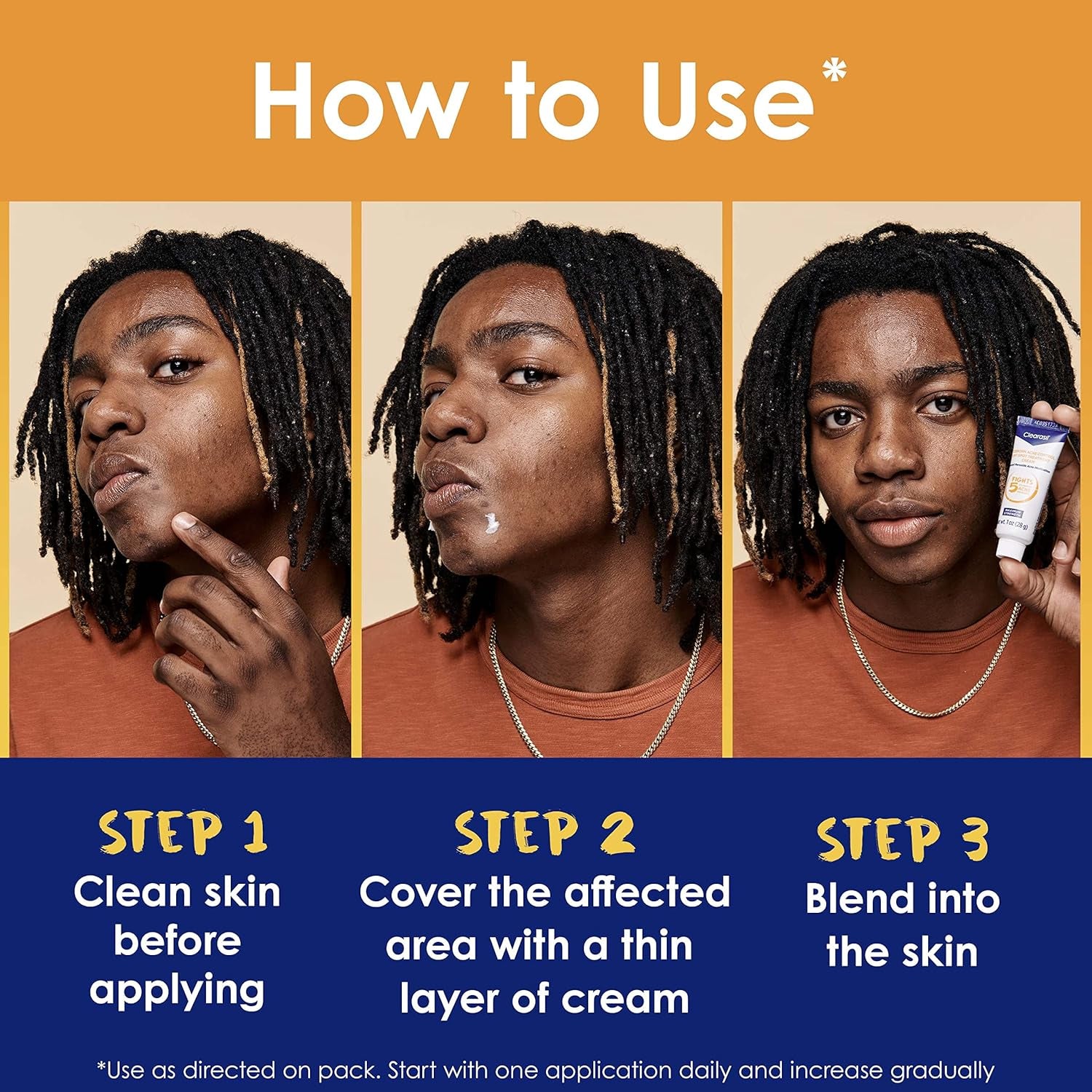 Acne Spot Treatment Cream