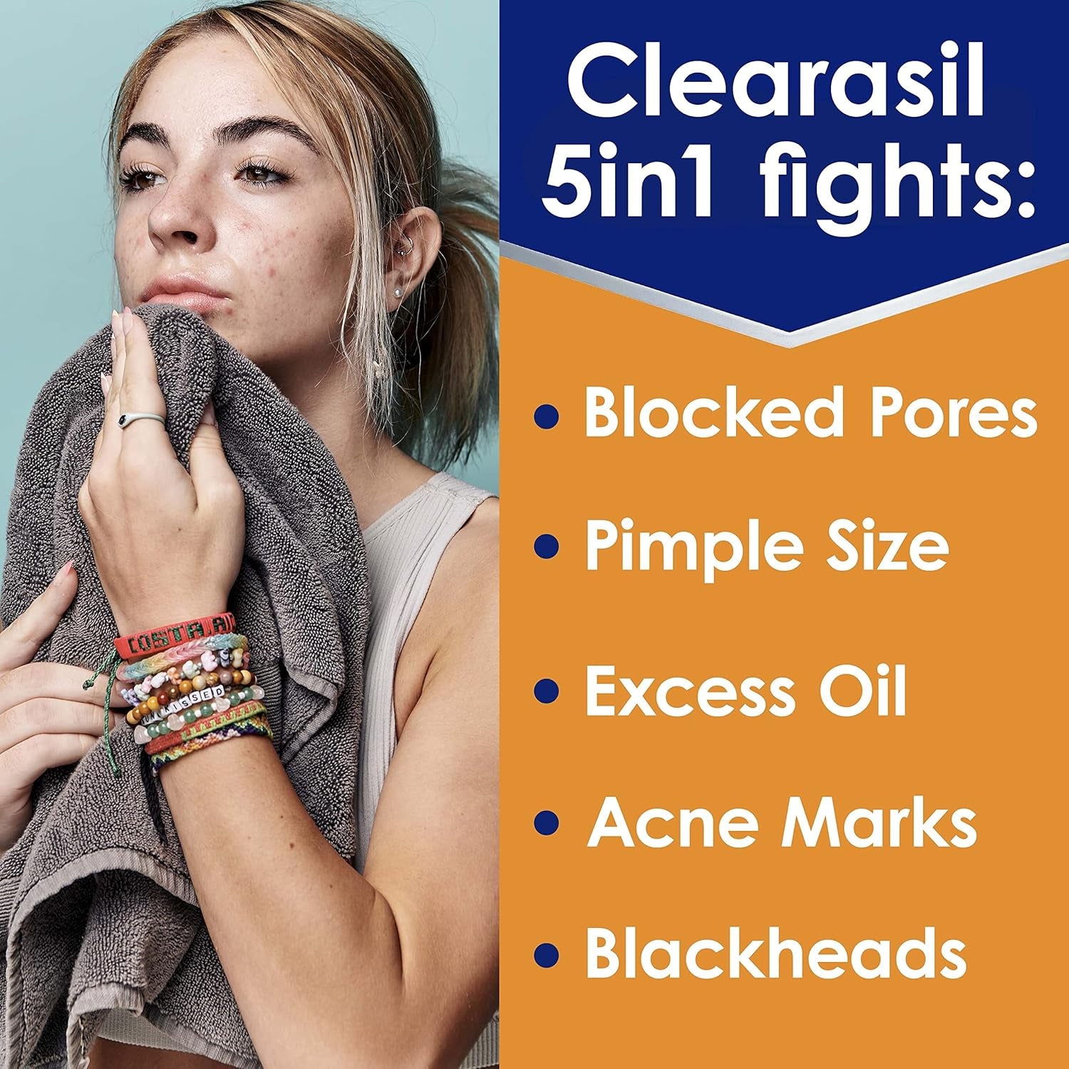 Acne Spot Treatment Cream